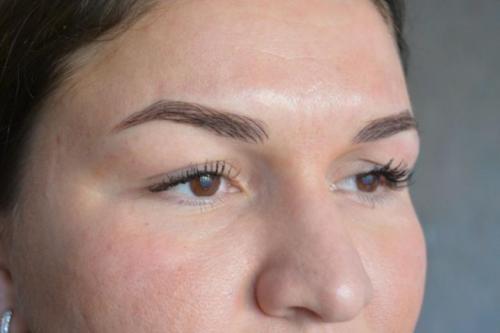 Какой татуаж бровей лучше. Выбираем татуаж по типу кожи 09 Какой татуаж бровей лучше. Выбираем татуаж по типу кожи 09