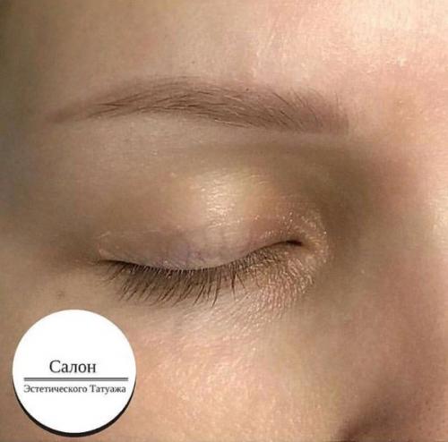 Способы удаления перманентного макияжа. Лазер – основное средство для удаления перманентного макияжа 07 Способы удаления перманентного макияжа. Лазер – основное средство для удаления перманентного макияжа 07
