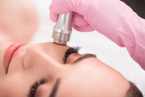 Способы удаления перманентного макияжа. Лазер – основное средство для удаления перманентного макияжа 04 Способы удаления перманентного макияжа. Лазер – основное средство для удаления перманентного макияжа 04