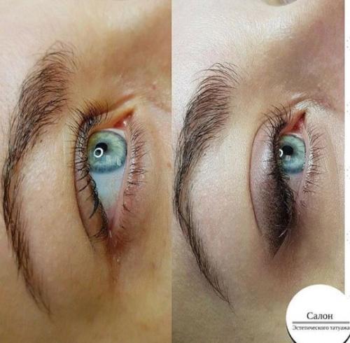 Удаление татуажа только профессионалы. Удаление татуажа лазером: самые популярные вопросы 01 Удаление татуажа только профессионалы. Удаление татуажа лазером: самые популярные вопросы 01