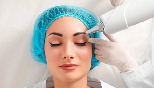 Способы удаления перманентного макияжа. Лазер – основное средство для удаления перманентного макияжа 02 Способы удаления перманентного макияжа. Лазер – основное средство для удаления перманентного макияжа 02