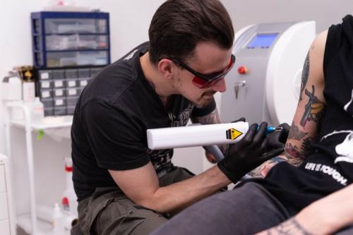 Как и чем удалить татуировку. Удаление тату: как быстро и безопасно избавиться от надоевшей татуировки 03 Как и чем удалить татуировку. Удаление тату: как быстро и безопасно избавиться от надоевшей татуировки 03