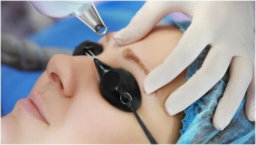 Лазерное удаление перманентного татуажа. Как удалить перманентный макияж 05 Лазерное удаление перманентного татуажа. Как удалить перманентный макияж 05