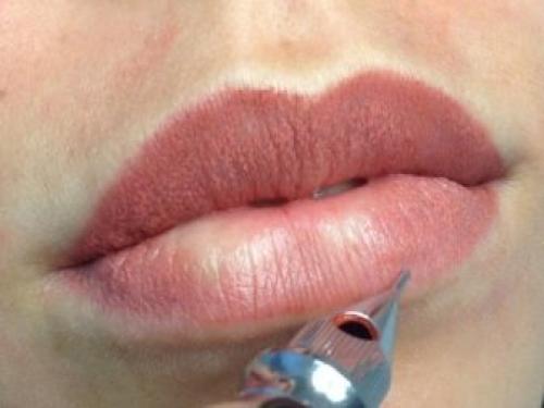 Удаление татуажа губ лазером. Показания и противопоказания 03