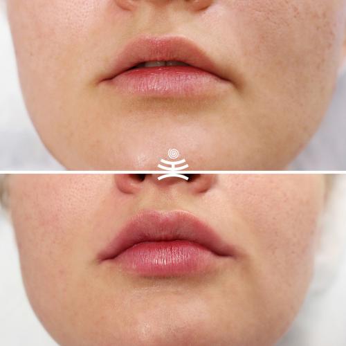 Пухлые губы. Бантик, ангел или купидон? Основные техники увеличения губ