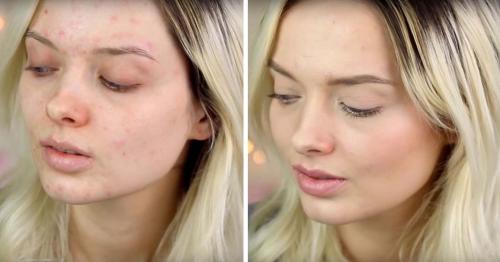 Как замазать прыщи тоналкой. Как с помощью тонального крема замазать прыщи на лице