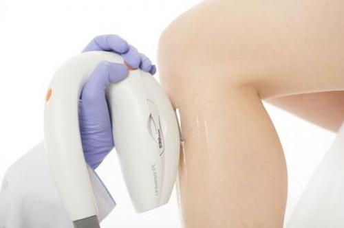 Лучшие лазеры для удаления перманентного макияжа. Принцип работы неодимового лазера 02