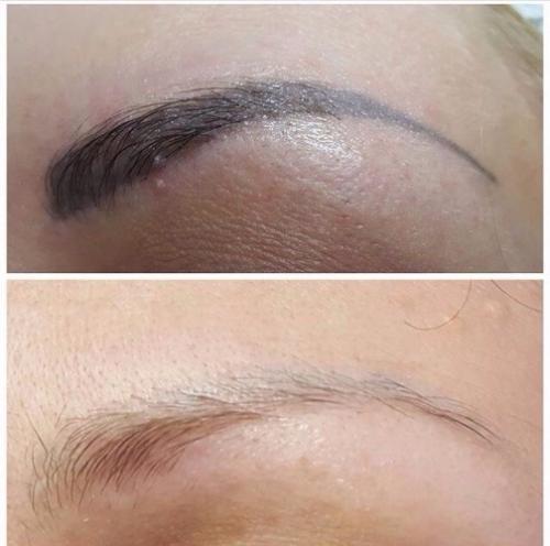 Как убрать татуаж бровей. Домашнее удаление перманентного макияжа 04 Как убрать татуаж бровей. Домашнее удаление перманентного макияжа 04