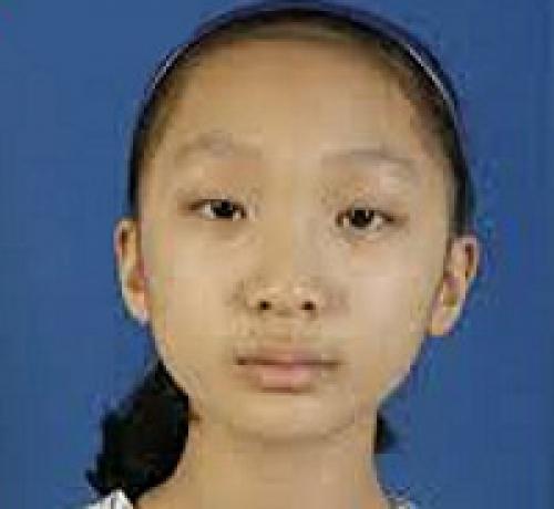 Форму глаз, как изменить. Кантопластика: виды и результат 01 Форму глаз, как изменить. Кантопластика: виды и результат 01