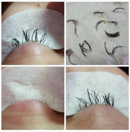 Норма выпадения нарощенных ресниц в день. ТОП-14 проблем с нарощенными ресницами: причины и последствия, что делать