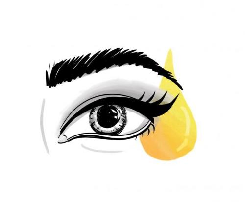 Выпали ресницы после наращивания, как восстановить. Как восстановить ресницы после наращивания?