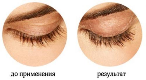 Гель для ускорения роста ресниц применение. Функциональные разновидности гелей