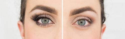 Выпадают нарощенные ресницы со своими. Основные причины выпадения ресниц