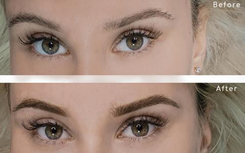 Последствия перманентного макияжа бровей. Последствия перманентного макияжа