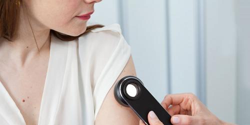 Бесцветная родинка. Симптомы заболевания