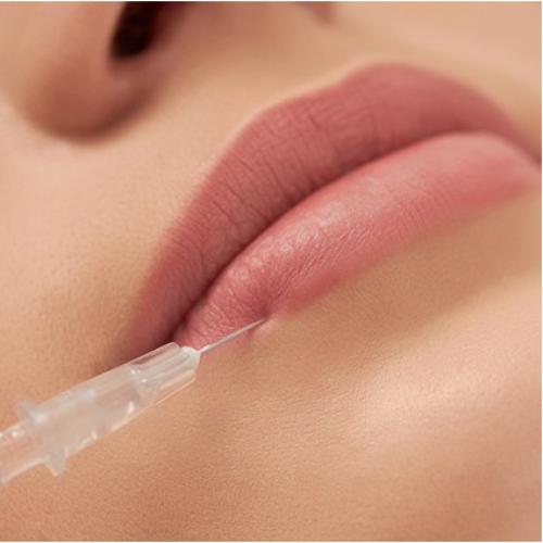 Отзыв о Увеличение губ гиалуроновой кислотой. Как увеличить губы, чтобы получить Red Carpet look? 02