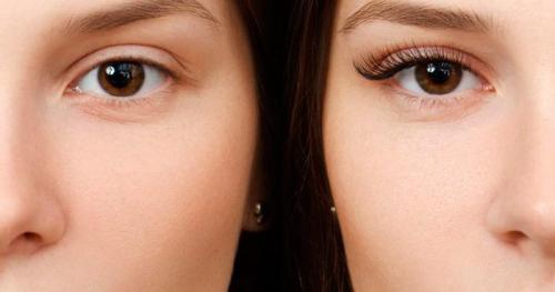 Лисий эффект схема. Что такое лисий эффект