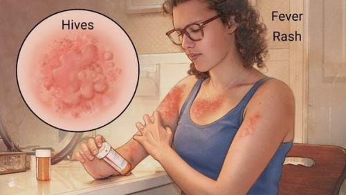 Минздрав объявил о четырех новых лекарствах для лечения коронавируса 04