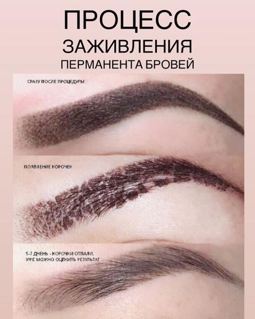 Заживление татуажа по дням. Этапы заживления татуажа 02