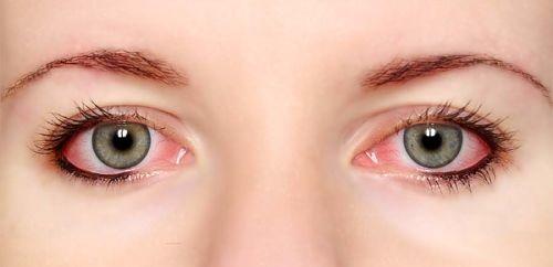 Лисий эффект наращивания ресниц 3D. Виды нарощенных ресниц с лисьим эффектом