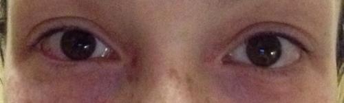 Как снять ресницы в домашних условиях без специальной жидкости форум. Миссия: снять нарощенные ресницы.