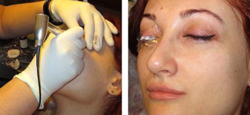 Межресничный татуаж до и после. Татуаж глаз: межресничный татуаж глаз, стрелки на глазах