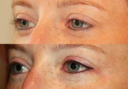 Межресничный татуаж до и после. Татуаж глаз: межресничный татуаж глаз, стрелки на глазах