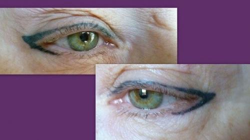 Неудачный межресничный татуаж. Неудачный татуаж межресничного пространства/Что делать ?