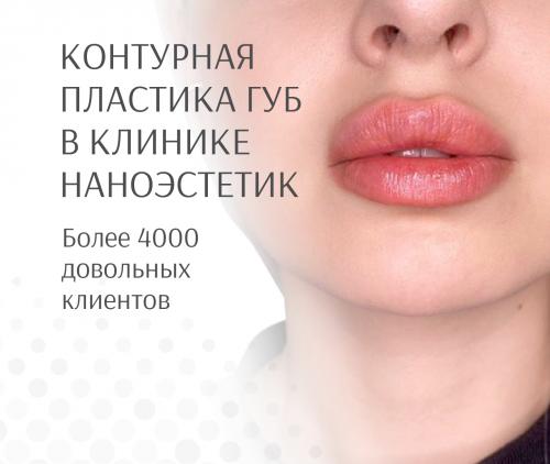 Как ухаживать за кожей с комедонами. Причины появления акне 04