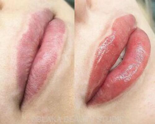 Вся правда о противопоказаниях к перманентному макияжу. Противопоказания к макияжу 08