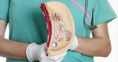 Лечение диффузной фиброзно-кистозной мастопатии. Классификация и стадии развития мастопатии 02