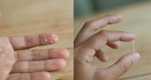 Кровянистые выделения после месячных. Выделения после месячных