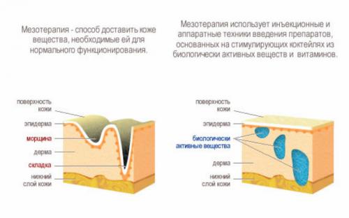 Можно ли делать биоревитализацию во время месячных. Можно ли делать чистку лица во время месячных 02