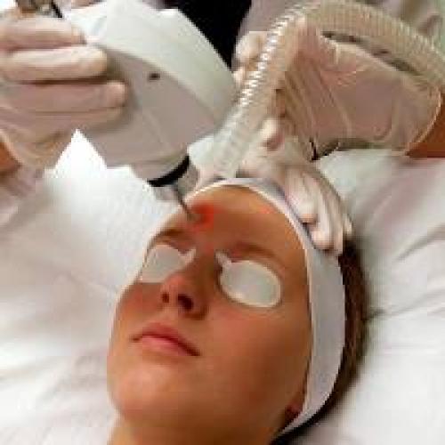 Сочетание биоревитализации с другими процедурами. Сочетается ли фотоомоложение лица лазером с другими процедурами? 01