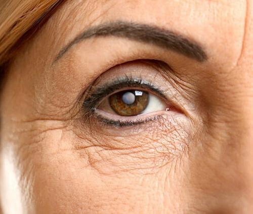 Красные глаза после наращивания ресниц. Причины покраснения глаз после наращивания 15 Красные глаза после наращивания ресниц. Причины покраснения глаз после наращивания 15