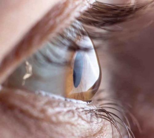 Красные глаза после наращивания ресниц. Причины покраснения глаз после наращивания 09 Красные глаза после наращивания ресниц. Причины покраснения глаз после наращивания 09