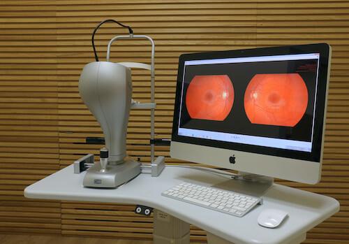 Красные глаза после наращивания ресниц. Причины покраснения глаз после наращивания 07 Красные глаза после наращивания ресниц. Причины покраснения глаз после наращивания 07