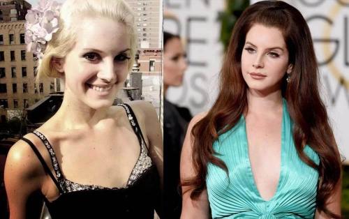 Lana Del Rey до пластики. Лана Дель Рей до и после пластики. Как поменялась звезда? 04