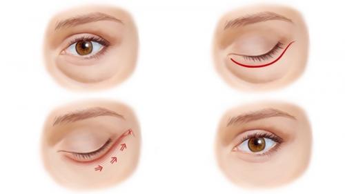 Чем убрать темные круги под глазами. Болезни внутренних органов 08