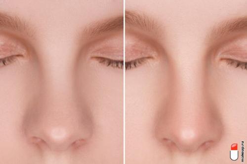 Какие приёмы макияжа помогают визуально уменьшить нос. Курсы моделирования: как сделать контуринг носа?