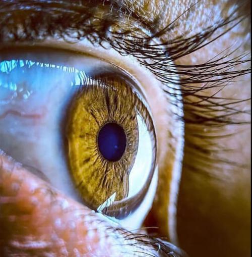 Почему слезятся и краснеют глаза после наращивания ресниц. Какие последствия для глаз могут быть после наращивания ресниц? 05 Почему слезятся и краснеют глаза после наращивания ресниц. Какие последствия для глаз могут быть после наращивания ресниц? 05