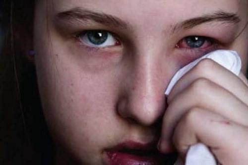 Секрет создания кошачьих глаз: какие эффекты дает наращивание ресниц 10