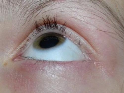 Ламинирование и ботокс ресниц. Что лучше — ботокс или ламинирование ресниц 02 Ламинирование и ботокс ресниц. Что лучше — ботокс или ламинирование ресниц 02