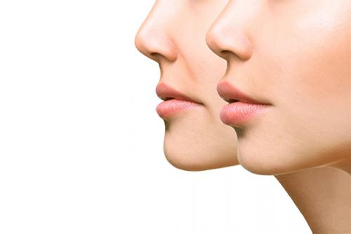 Увеличение губ гиалуроновой кислотой. Этапы процедуры увеличение губ гиалуроновой кислотой 08 Увеличение губ гиалуроновой кислотой. Этапы процедуры увеличение губ гиалуроновой кислотой 08