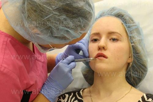 Увеличение губ гиалуроновой кислотой. Этапы процедуры увеличение губ гиалуроновой кислотой 05 Увеличение губ гиалуроновой кислотой. Этапы процедуры увеличение губ гиалуроновой кислотой 05
