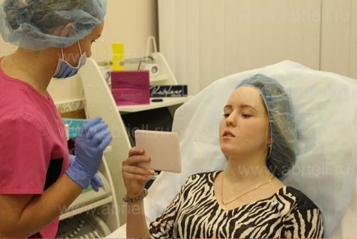 Увеличение губ гиалуроновой кислотой. Этапы процедуры увеличение губ гиалуроновой кислотой 07 Увеличение губ гиалуроновой кислотой. Этапы процедуры увеличение губ гиалуроновой кислотой 07