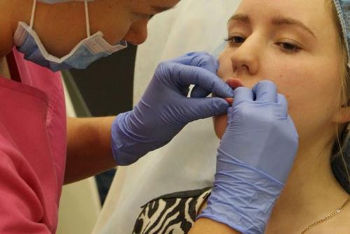 Увеличение губ гиалуроновой кислотой. Этапы процедуры увеличение губ гиалуроновой кислотой 06 Увеличение губ гиалуроновой кислотой. Этапы процедуры увеличение губ гиалуроновой кислотой 06