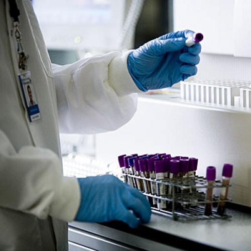 15 признаков сахарного диабета. Симптомы сахарного диабета 2 типа 02 15 признаков сахарного диабета. Симптомы сахарного диабета 2 типа 02