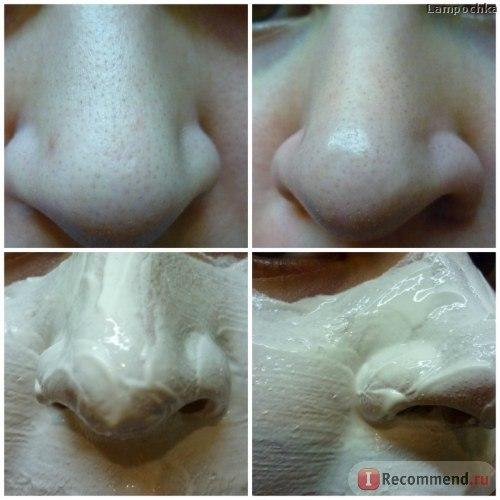 В наличии!  Легендарная массажная маска! 03