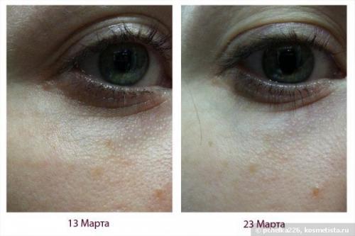 В наличии! Mizon Snail Repair Eye Cream. 03 В наличии! Mizon Snail Repair Eye Cream. 03